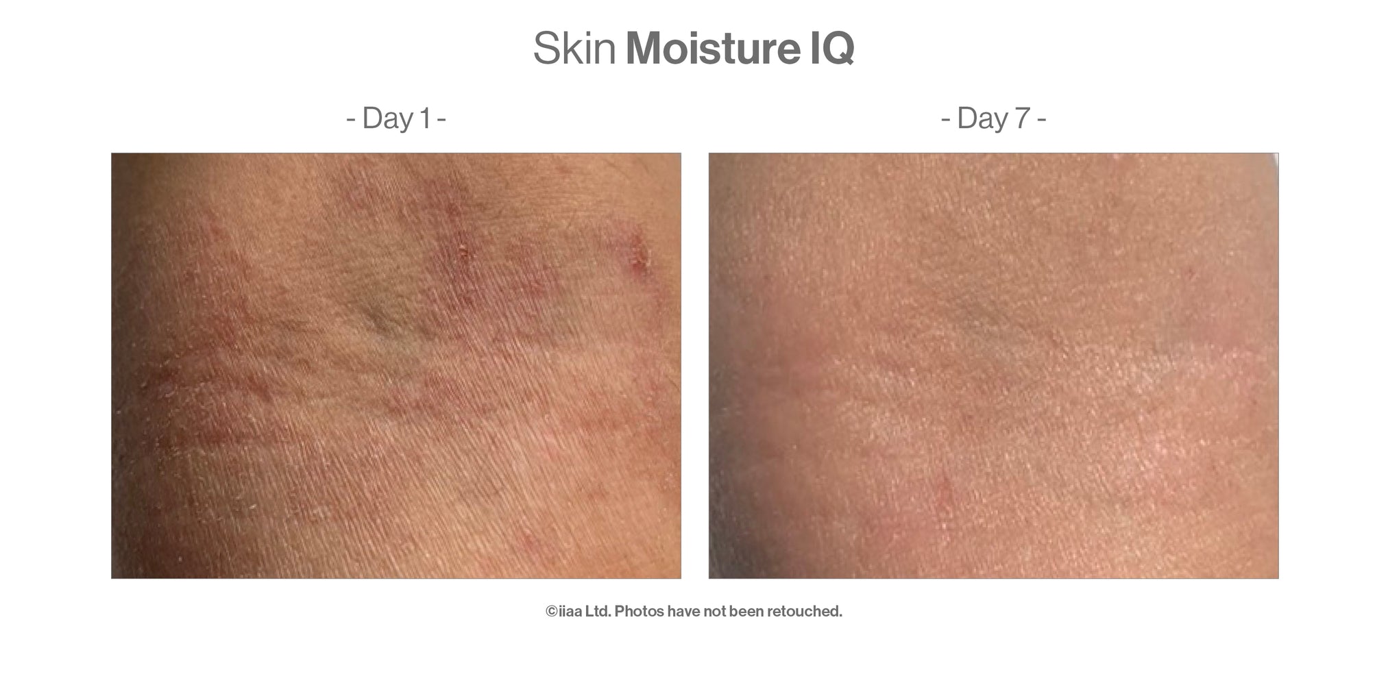 Advanced Nutrition Programme Skin Moisture IQ - Dry Skin Supplement Pods
