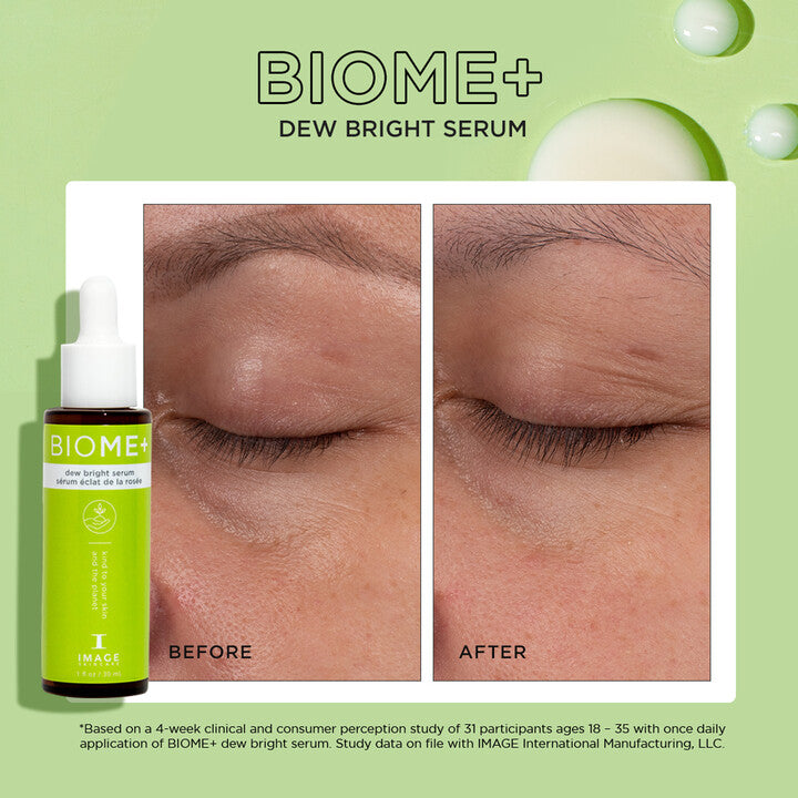 Image Skincare Biome+ Dew Bright Serum ( 30ml )