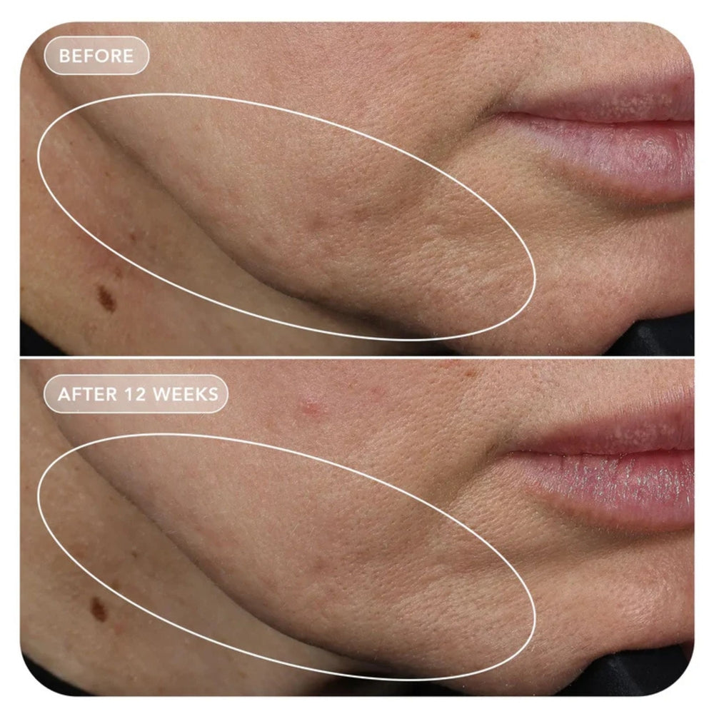 Image Skincare VOL.U.LIFT Lifting & Firming Cream