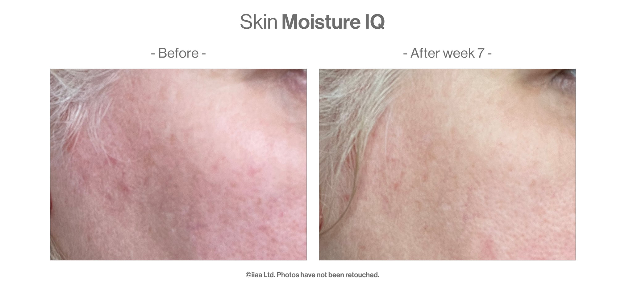 Advanced Nutrition Programme Skin Moisture IQ - Dry Skin Supplement Pods