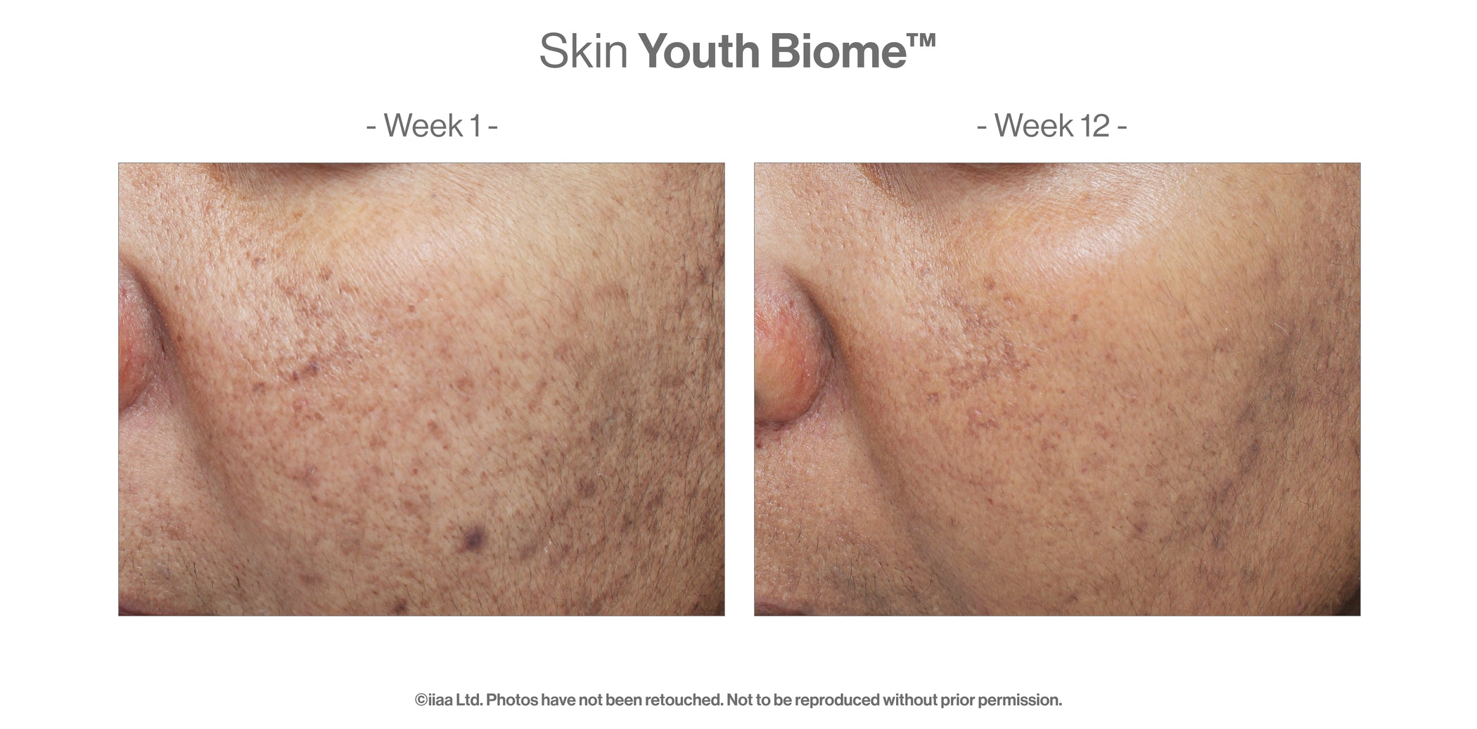 Advanced Nutrition Programme Skin Youth Biome (30 Capsules)