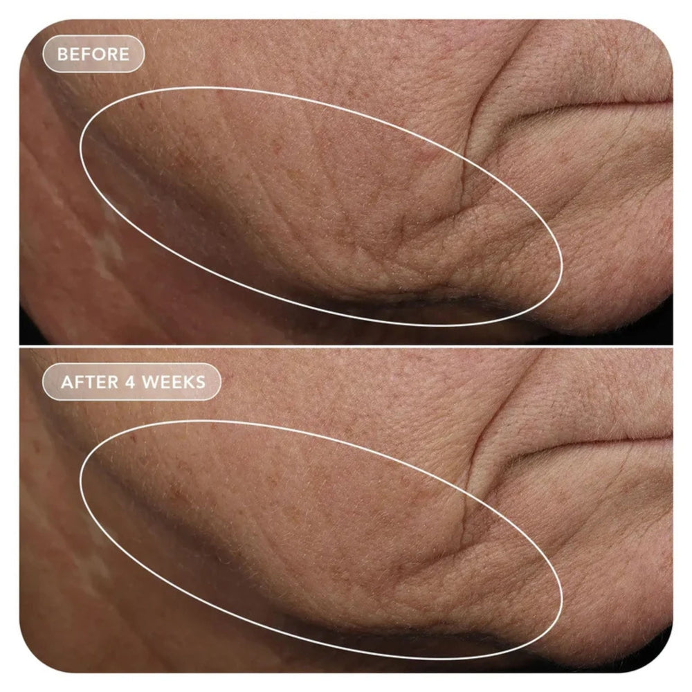Image Skincare VOL.U.LIFT Lifting & Firming Cream